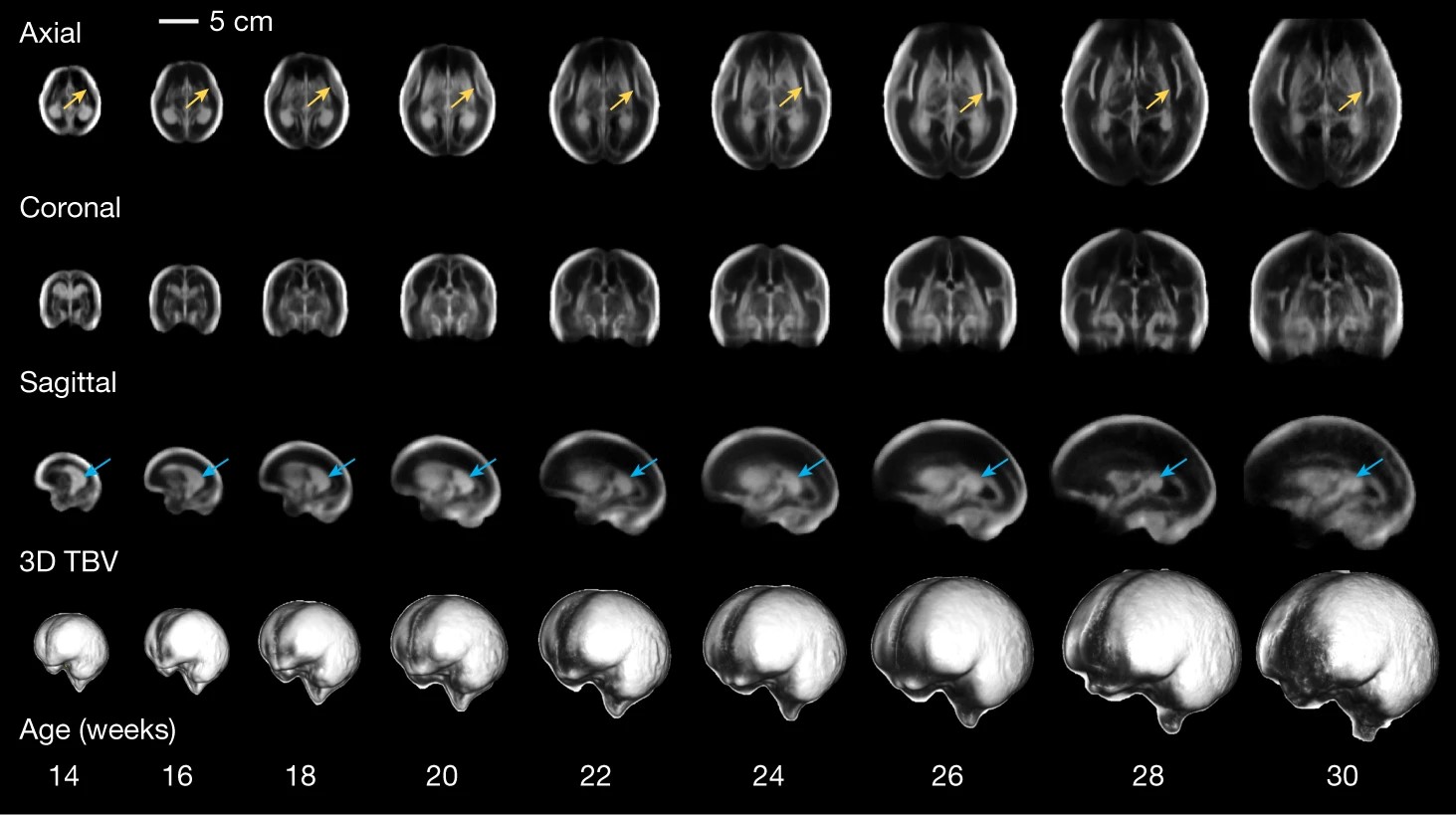 Image showing a&nbsp;3D&thinsp;+&thinsp;time atlas templates depicting the fetal brain at even gestational weeks for the axial (top), coronal (middle) and sagittal (bottom) views