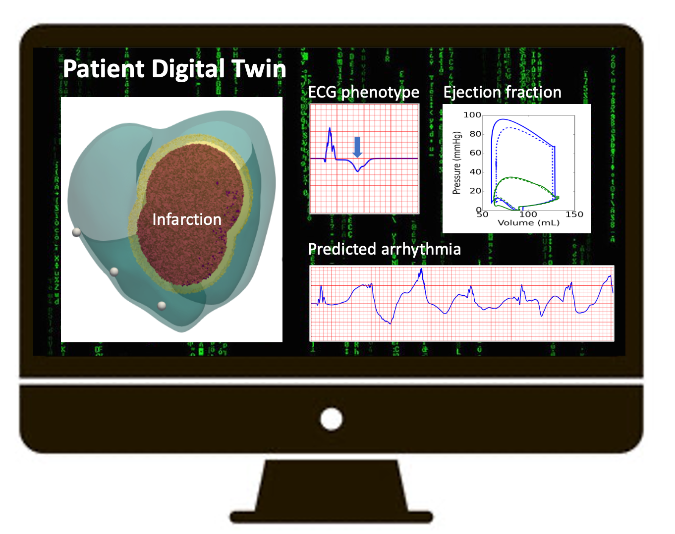 A mocked-up image of a computer screen, comprising illustrations of the patient digital twin tests, including ECG phenotype, Ejection fraction and Predicted arrhythmia charts.